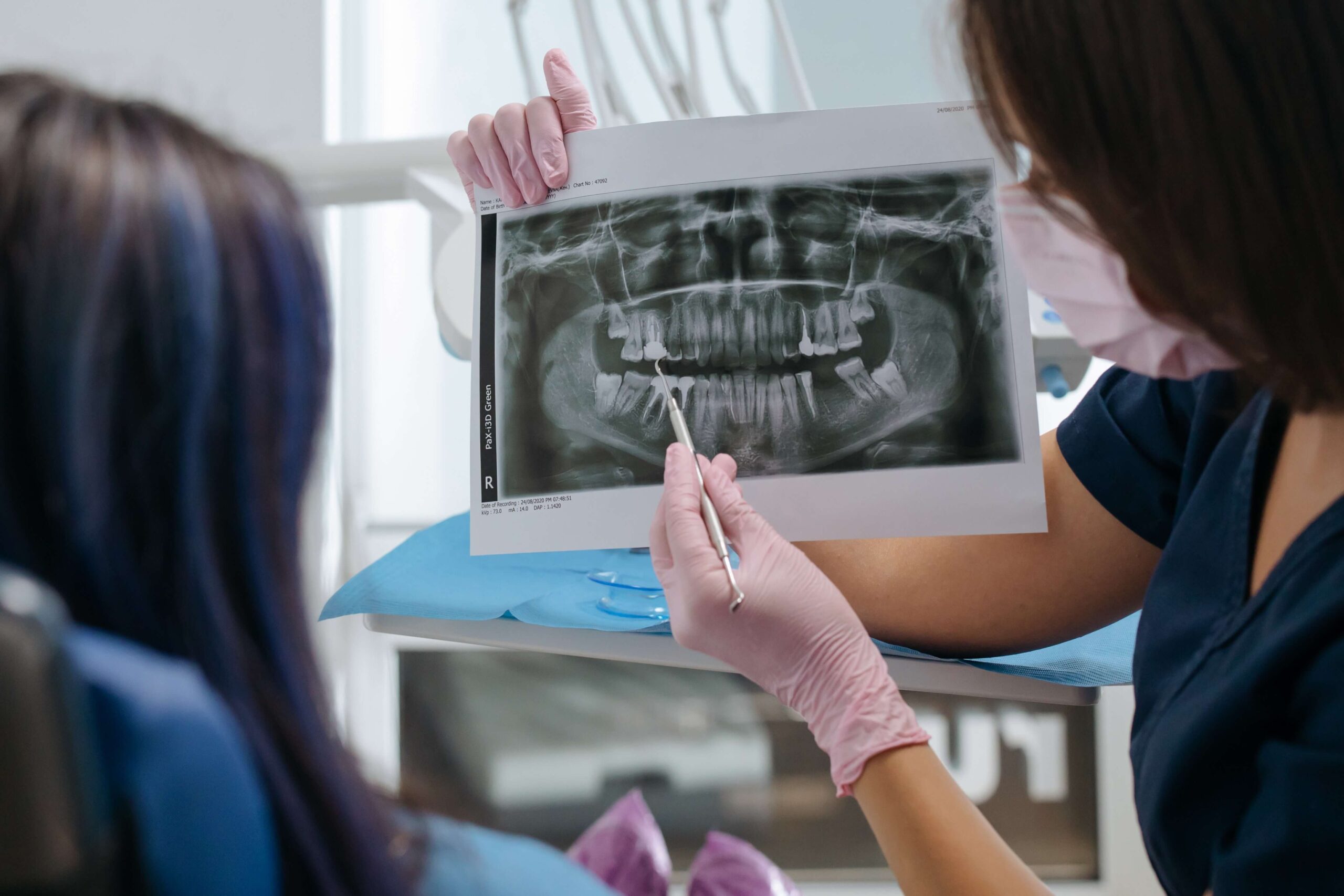 Martwy Ząb Co To Znaczy Przyczyny I Sposoby Leczenia Allsmiles Dental 8758